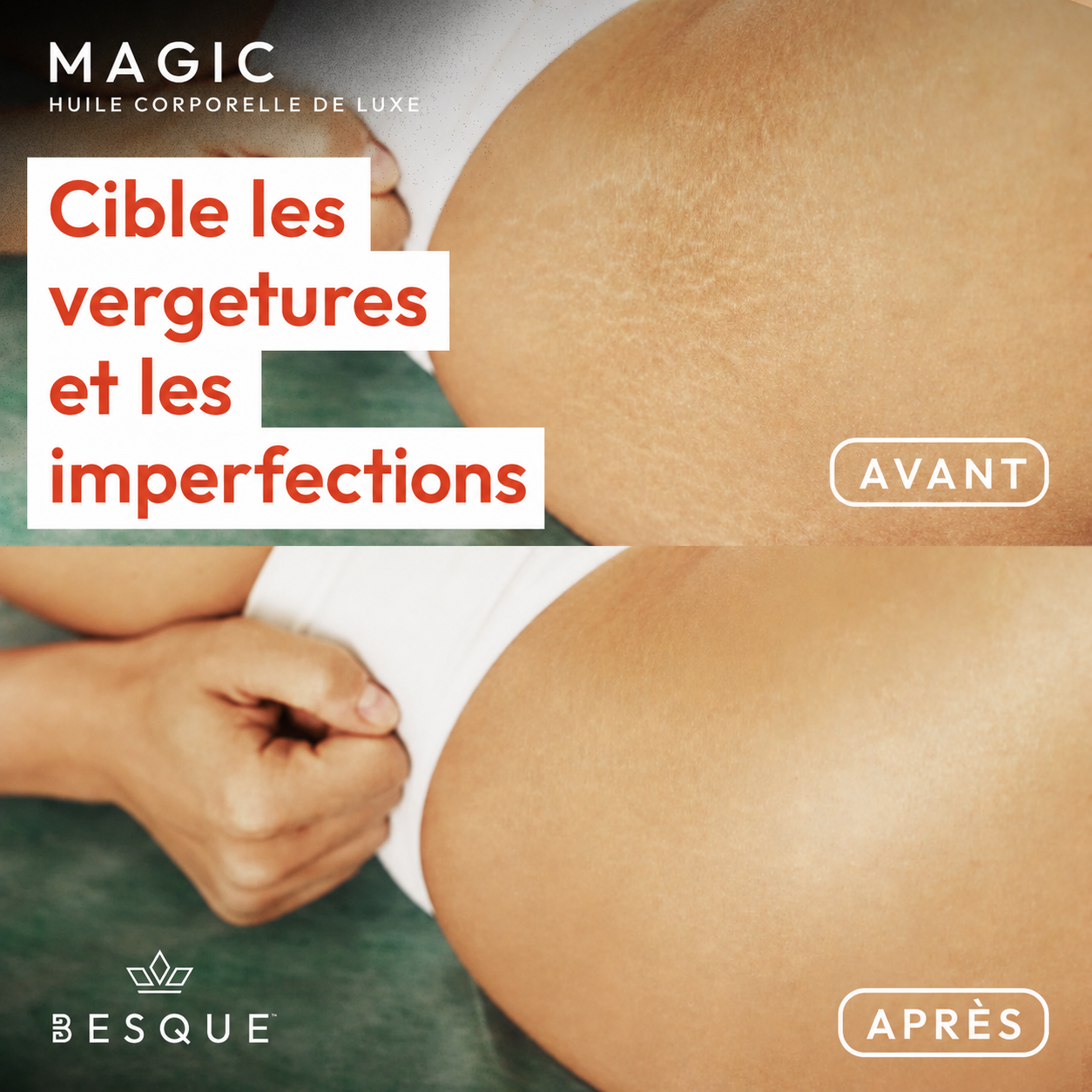 Huile corporelle magique Besque® – Sans parfum 100mL
