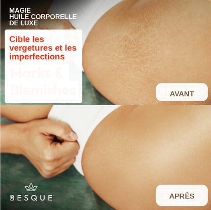 Huile Corporelle Magique Besque® 100mL